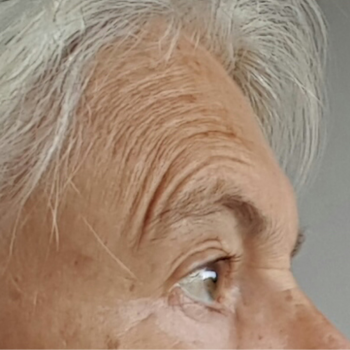 voor4